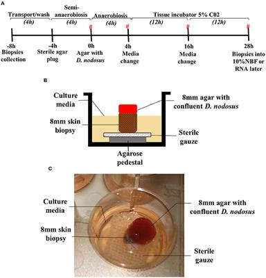 A Novel 3D Skin Explant Model to Study Anaerobic Bacterial Infection